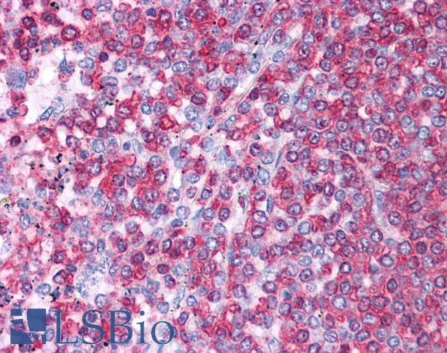 Anti-HSPA8 / HSC70 antibody IHC of human spleen. Immunohistochemistry of formalin-fixed, paraffin-embedded tissue after heat-induced antigen retrieval. Antibody LS-B4670 concentration 5 ug/ml.