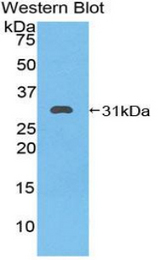 Western blot of recombinant HSPA9 / Mortalin / GRP75.