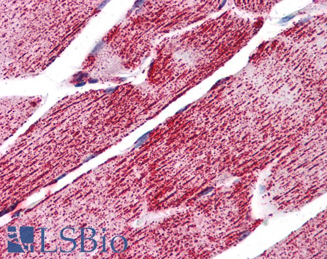 Anti-GRP75 antibody IHC of human skeletal muscle. Immunohistochemistry of formalin-fixed, paraffin-embedded tissue after heat-induced antigen retrieval. Antibody LS-B5579 concentration 5 ug/ml.