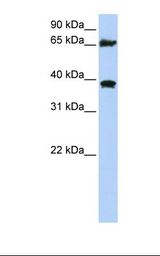 293T cell lysate. Antibody concentration: 1.0 ug/ml. Gel concentration: 12%.