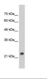 HepG2 Cell Lysate