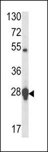 Western blot of HSP27 antibody in MCF-7 cell line lysates (35 ug/lane). HSP27 (arrow) was detected using the purified antibody.