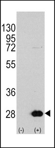 Western blot of HSPB1 (arrow) using rabbit polyclonal HSPB1 Antibody (S78) (RB11380). 293 cell lysates (2 ug/lane) either nontransfected (Lane 1) or transiently transfected with the HSPB1 gene (Lane 2) (Origene Technologies).