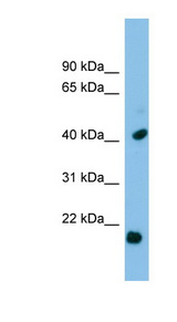 HSPB2 antibody LS-C116354 Western blot of ACHN lysate.