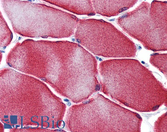 Anti-HSPB7 / CvHSP antibody IHC of human skeletal muscle. Immunohistochemistry of formalin-fixed, paraffin-embedded tissue after heat-induced antigen retrieval. Antibody LS-B6223 concentration 3 ug/ml.