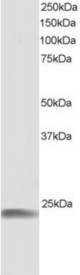 Antibody staining (1 ug/ml) of human muscle lysate (RIPA buffer, 30 ug total protein per lane). Primary incubated for 1 hour. Detected by Western blot of chemiluminescence.