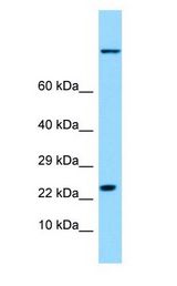 HSPB9 antibody Western Blot of Fetal Lung.
