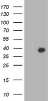HEK293T cells were transfected with the pCMV6-ENTRY control (Left lane) or pCMV6-ENTRY HSPBP1 (Right lane) cDNA for 48 hrs and lysed. Equivalent amounts of cell lysates (5 ug per lane) were separated by SDS-PAGE and immunoblotted with anti-HSPBP1.