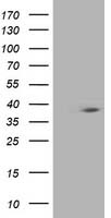 HEK293T cells were transfected with the pCMV6-ENTRY control (Left lane) or pCMV6-ENTRY HSPBP1 (Right lane) cDNA for 48 hrs and lysed. Equivalent amounts of cell lysates (5 ug per lane) were separated by SDS-PAGE and immunoblotted with anti-HSPBP1.