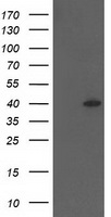 HEK293T cells were transfected with the pCMV6-ENTRY control (Left lane) or pCMV6-ENTRY HSPBP1 (Right lane) cDNA for 48 hrs and lysed. Equivalent amounts of cell lysates (5 ug per lane) were separated by SDS-PAGE and immunoblotted with anti-HSPBP1.