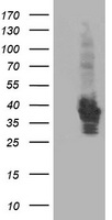 HEK293T cells were transfected with the pCMV6-ENTRY control (Left lane) or pCMV6-ENTRY HSPBP1 (Right lane) cDNA for 48 hrs and lysed. Equivalent amounts of cell lysates (5 ug per lane) were separated by SDS-PAGE and immunoblotted with anti-HSPBP1.