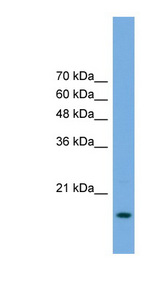 POP5 antibody LS-C135406 Western blot of Transfected 293T cell lysate.