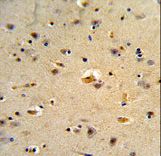 Formalin-fixed and paraffin-embedded human brain tissue reacted with CDK5RAP1 Antibody , which was peroxidase-conjugated to the secondary antibody, followed by DAB staining. This data demonstrates the use of this antibody for immunohistochemistry; clinical relevance has not been evaluated.