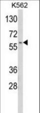 Western blot of CDK5RAP1 Antibody in K562 cell line lysates (35 ug/lane). CDK5RAP1 (arrow) was detected using the purified antibody.