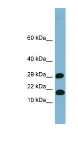 TRAPPC2L antibody LS-C107819 Western blot of Fetal Heart lysate.