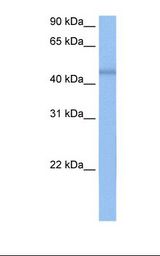 MCF7 cell lysate. Antibody concentration: 0.5 ug/ml. Gel concentration: 12%.