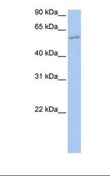 Jurkat cell lysate. Antibody concentration: 1.0 ug/ml. Gel concentration: 12%.