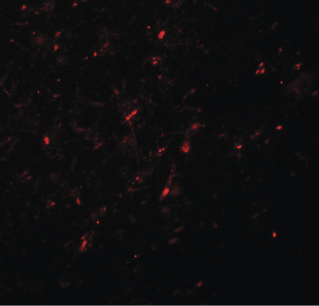 Immunofluorescence of NGN2 in human brain tissue with NGN2 antibody at 20 ug/ml.