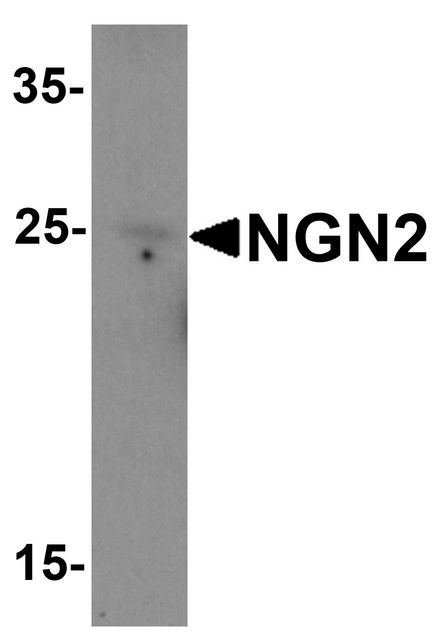Western blot analysis of NGN2 in mouse small intestine tissue lysate with NGN2 antibody at (A) 1 and (B) 2 ug/ml.