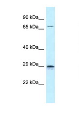 NEUROG2 / NGN2 antibody LS-C145860 Western blot of Small Intestine lysate. Antibody concentration 1 ug/ml.