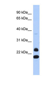 NEUROG2 / NGN2 antibody LS-C110410 Western blot of Fetal Thymus lysate.