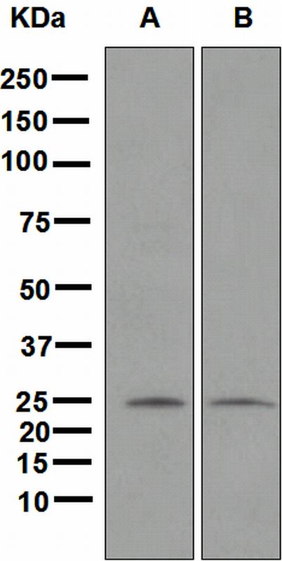 Western blot analysis on (A) SH-SY5Y and (B) HepG2 cell lysates using anti-Neurogenin-2 antibody.