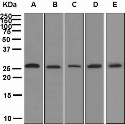 Western blot analysis on (A) HeLa, (B) SH-SY5Y, (C) U87-MG, (D) HepG2, and (E) fetal liver lysates using anti-Neurogenin-2 antibody.