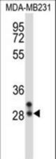 NEUROG2 Antibody western blot of MDA-MB231 cell line lysates (35 ug/lane). The NEUROG2 antibody detected the NEUROG2 protein (arrow).