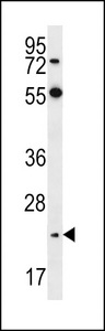 Neurogenin2 Antibody (D235) western blot of HeLa cell line lysates (35 ug/lane). The Neurogenin2 antibody detected the Neurogenin2 protein (arrow).