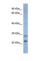 NEUROG3 / NGN3 antibody LS-C145428 Western blot of Mouse Pancreas lysate. Antibody concentration 1 ug/ml.