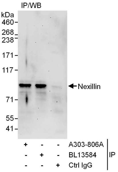 Detection of Human Nexillin by Western Blot of Immunoprecipitates. Samples: Whole cell lysate (1 mg for IP, 20% of IP loaded) from 293T cells. Antibodies: Affinity purified rabbit anti-Nexillin antibody used for IP at 6 ug/mg lysate. Nexillin was also immunoprecipitated by rabbit anti-Nexillin antibody BL13584, which recognizes a downstream epitope. For blotting immunoprecipitated Nexillin, rabbit anti-Nexillin antibody BL13585 was used at 1 mcg/ml. Detection: Chemiluminescence with an exposure time of 3 minutes.