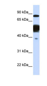 NEXN antibody LS-C102280 Western blot of Fetal Liver lysate.