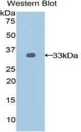 Western blot of recombinant NEXN / Nexilin.
