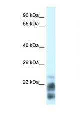 MDP1 antibody LS-C108076 Western blot of HeLa Cell lysate. Antibody concentration 1 ug/ml.
