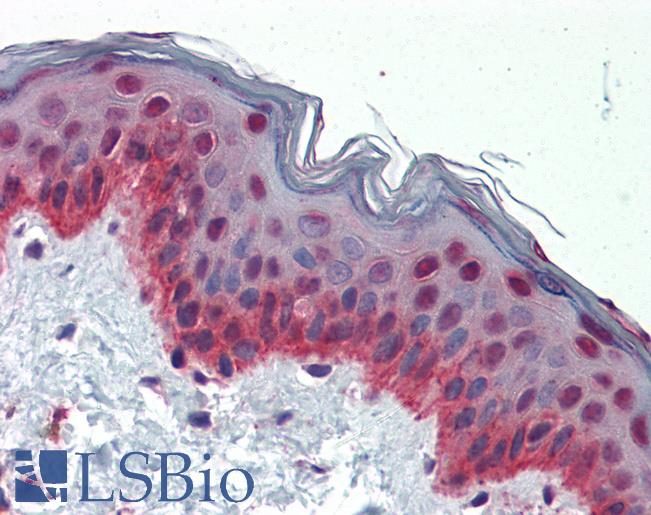 Anti-NFIX antibody IHC of human skin. Immunohistochemistry of formalin-fixed, paraffin-embedded tissue after heat-induced antigen retrieval. Antibody LS-B3497 concentration 5 ug/ml.