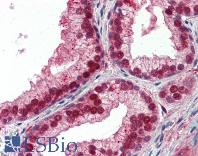 Anti-NFIX antibody IHC of human prostate. Immunohistochemistry of formalin-fixed, paraffin-embedded tissue after heat-induced antigen retrieval. Antibody LS-B3497 concentration 5 ug/ml.