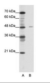 A: Marker, B: Jurkat Cell Lysate.
