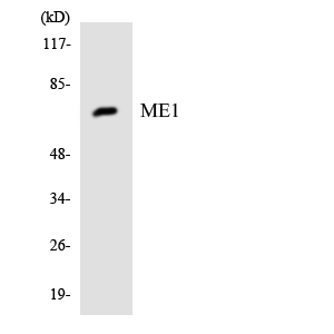 Western blot of the lysates from HeLa cells using ME1 antibody.