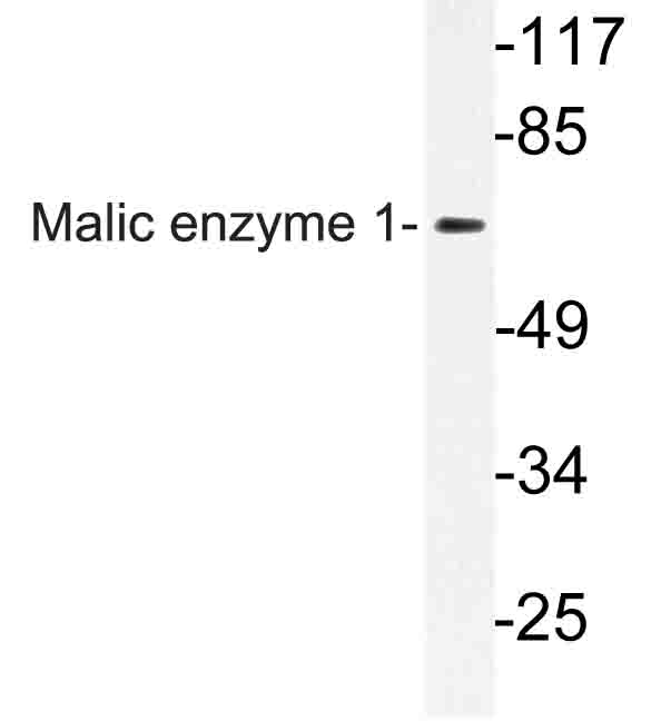 Western blot of Malic enzyme 1 (Y500) pAb in extracts from HeLa cells.