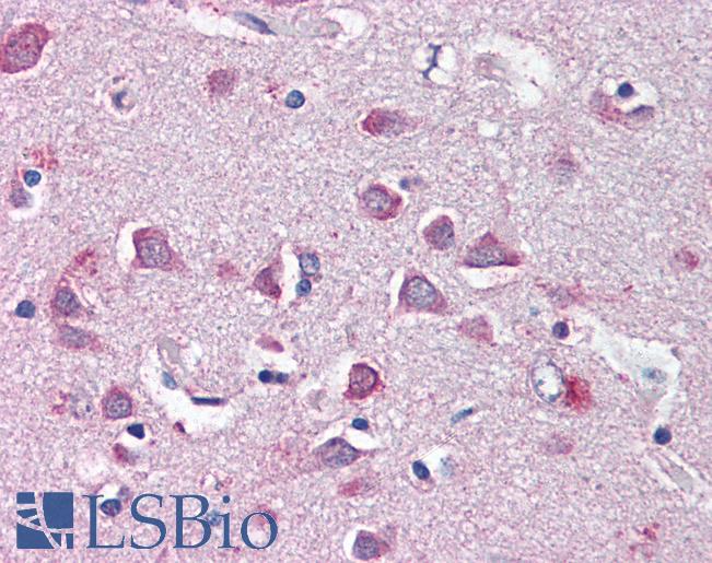 Anti-NF2 antibody IHC of human brain, cortex. Immunohistochemistry of formalin-fixed, paraffin-embedded tissue after heat-induced antigen retrieval. Antibody LS-B2336 concentration 5 ug/ml.
