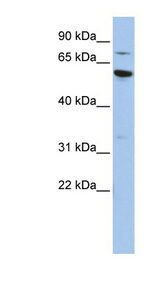 ME1 antibody LS-C101411 Western blot of HepG2 cell lysate.