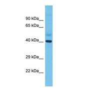 Western blot of Human Lymph Node Tumor. ME1 antibody dilution 1.0 ug/ml.