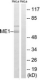 Western blot of extracts from HeLa cells, using ME1 Antibody. The lane on the right is treated with the synthesized peptide.