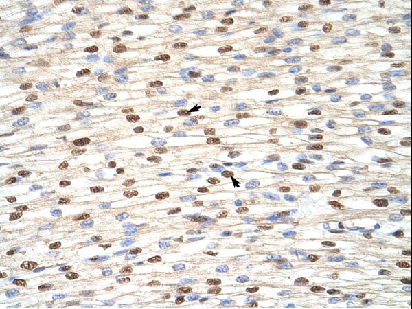 ILF3 antibody LS-C30315 was used in IHC to stain formalin-fixed, paraffin-embedded human heart.