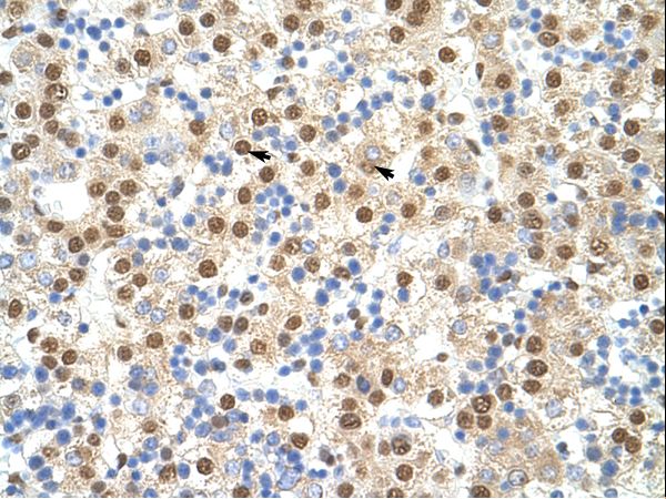 ILF3 antibody LS-C30315 was used in IHC to stain formalin-fixed, paraffin-embedded human liver.