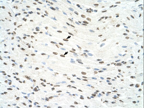 ILF3 antibody LS-C30453 was used in IHC to stain formalin-fixed, paraffin-embedded human muscle.