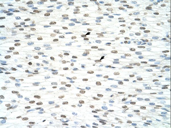 ILF3 antibody LS-C30453 was used in IHC to stain formalin-fixed, paraffin-embedded human heart.