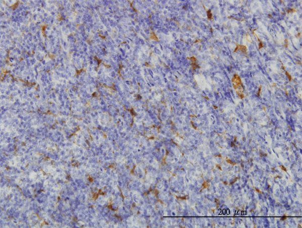 Immunoperoxidase of monoclonal antibody to ME1 on formalin-fixed paraffin-embedded human tonsil. [antibody concentration 0.5 ug/ml]