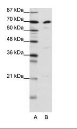 A: Marker, B: K562 Cell Lysate
