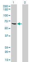 Western blot of ME1 expression in transfected 293T cell line by ME1 monoclonal antibody (M03), clone 3H5.